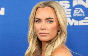 Teddi Mellencamp “chorou” quando viu suas cicatrizes de cirurgia de câncer pela primeira vez Teddi Mellencamp revela que está passando por uma cirurgia cerebral depois que os médicos encontraram vários tumores