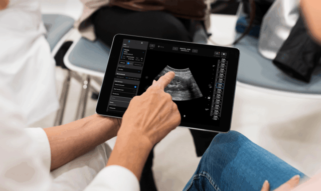 A Samsung pode investir em uma rodada de US $ 100 milhões para iniciar o EXO de imagens médicas


