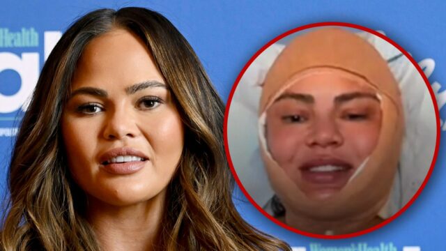 A relação do Instagram de Chrissy Teigen revelará a cirurgia Chrisa-Telien-Getty Ig 1