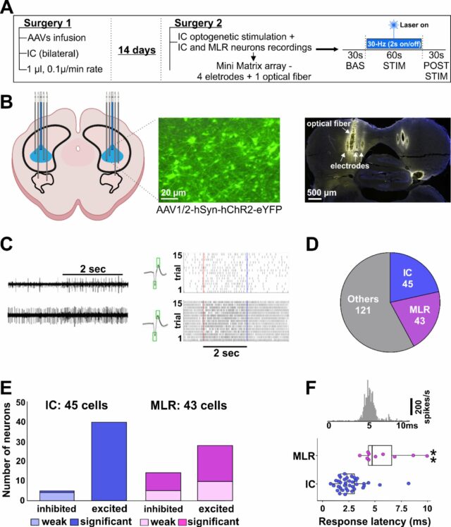 Como a estimulação cerebral alivia os sintomas da doença de Parkinson