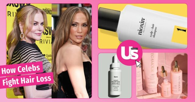 Dez celebridades que sofrem de perda de cabelo e o que elas usam para lutar



