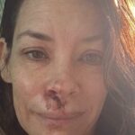 Evangeline Lilly desmaiou e caiu de seu rosto na praia Boulder