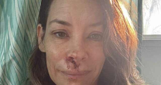 Evangeline Lilly desmaiou e caiu de seu rosto na praia Boulder 