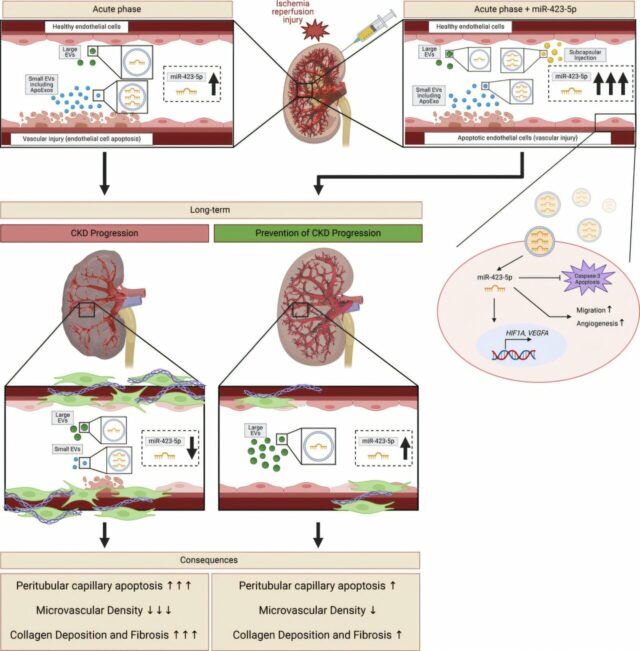 Insuficiência renal crônica: descoberta por um biomarcador crucial