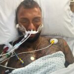O Sr. Wilkinson foi colocado em coma induzido por medicina depois de sofrer os efeitos colaterais de anos de uso de esteróides