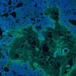 Melhor que as costuras desenvolvem patches bio -compatíveis com cientistas para danos aos órgãos suaves