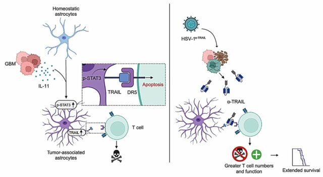 Faróis de pesquisa: Nova estratégia terapêutica impede que o glioblastoma encapsule o sistema imunológico