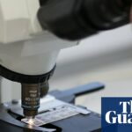 Novo teste de IA pode prever quais homens se beneficiarão do medicamento do câncer de próstata
