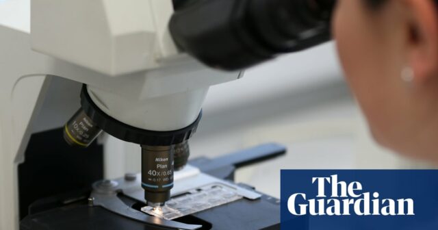 Novo teste de IA pode prever quais homens se beneficiarão do medicamento do câncer de próstata

