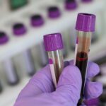 amostra de sangue