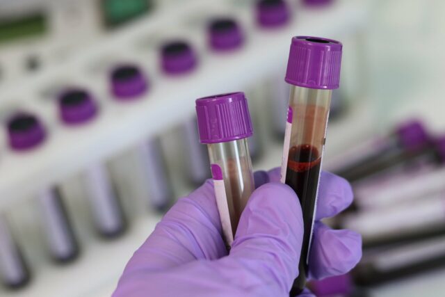 amostra de sangue