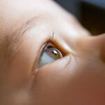 SUROU SUREM ANTERIOR segmento OCT pode ajudar a separar o glaucoma na primeira infância