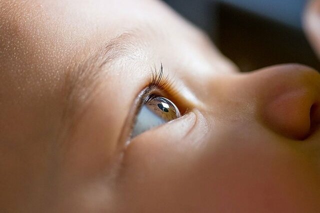 SUROU SUREM ANTERIOR segmento OCT pode ajudar a separar o glaucoma na primeira infância