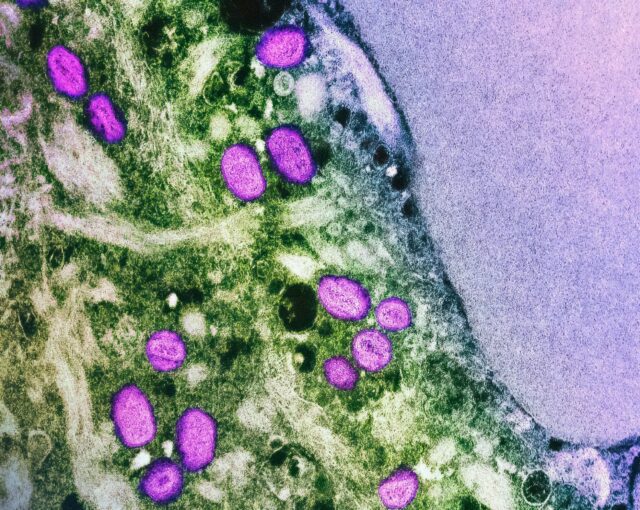 MPOX
