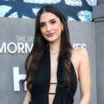 Sophia Umansky compartilha uma dramática situação de perda de cabelo