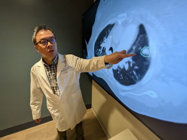 A IA corresponde aos médicos ao mapear tumores pulmonares para radioterapia