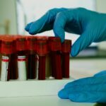 amostra de sangue