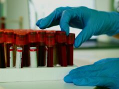 O teste de biópsia líquida pode levar a diagnósticos mais precoces para vários tipos de câncer amostra de sangue