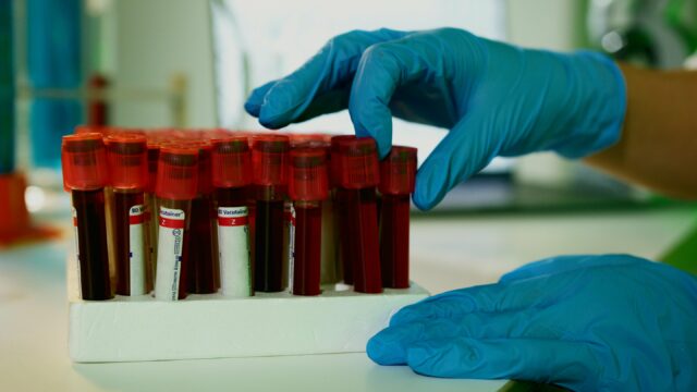amostra de sangue