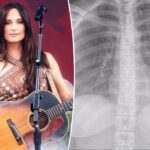 A estrela da música country, Kacey Musgrave, coloca o show depois de quebrar a costela: "Este s -t não é uma piada"