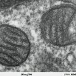 Antibióticos e hibitores de energia matam efetivamente células de melanoma agressivas bloqueando estradas mitocondriais