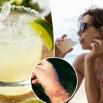 Cuidado com "Margarita Burn" - esta doença compartilhada pode fazer um uivo de dor