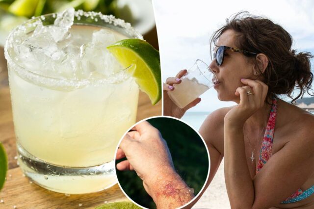 Cuidado com "Margarita Burn" - esta doença compartilhada pode fazer um uivo de dor

