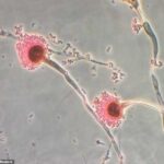 O fungo Aspergillus é um fungo tóxico que mata até 50 % dos pacientes. Mas os cientistas encontraram algumas formas disso podem ajudar a tratar a leucemia
