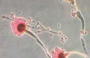 Os cientistas transformam fungos antigos mortais em um pote potencial de câncer O fungo Aspergillus é um fungo tóxico que mata até 50 % dos pacientes. Mas os cientistas encontraram algumas formas disso podem ajudar a tratar a leucemia