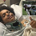 Um adolescente de Nova York descreve o momento aterrorizante em que um raio o atingiu em Central Park: "Eu aparentemente tenho sorte"