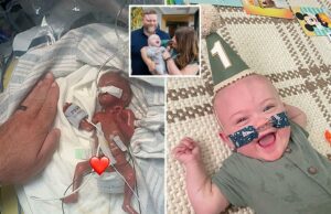 A criança mais prematura do mundo se opõe a todas as oportunidades médicas para alcançar o 1º aniversário A criança mais prematura do mundo se opõe a todas as oportunidades médicas para alcançar o 1º aniversário