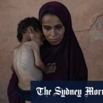 Muhammad Zakariya Ayyoub al-Matouq, 1, é contra a desnutrição com risco de vida.