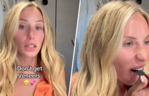 Alix Earle explica com a lágrima por que ele se arrepende do trabalho odontológico enquanto apresentava dente Alix Earle