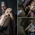 As imagens virais do garoto faminto não contam a história toda porque ele sofre de distúrbios genéticos, como dizem os críticos