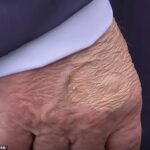 A maquiagem parecia cobrir uma projeção circular da pele que os médicos disseram a DailyMail.com provavelmente foi o resultado de uma corrente sanguínea de rotina