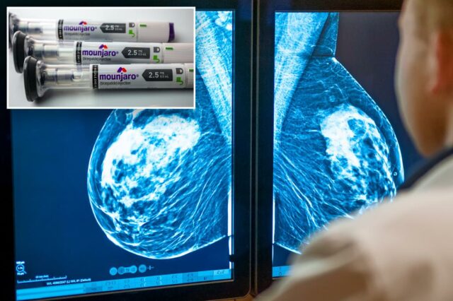 Boobs Mounjaro? Um novo teste, um medicamento para emagrecimento, pode reduzir os tumores de câncer de mama

