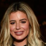 A Brielle Biermann compartilha seus resultados após dissolver o enchimento sob o olho A3C59199-38A7-4F97-B8C1-C2C06640520C_1753807787
