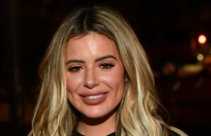 Brielle Biermann revela sua nova aparição depois de se dissolver sob o recheio A Brielle Biermann compartilha seus resultados após dissolver o enchimento sob o olho A3C59199-38A7-4F97-B8C1-C2C06640520C_1753807787