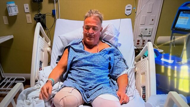 Back Bagging 1 no Hospital 1