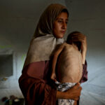 Como uma imagem viral é alimentada, a luta nos relatórios da fome em Gaza