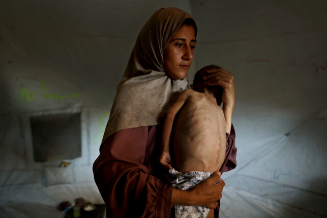 Como uma imagem viral é alimentada, a luta nos relatórios da fome em Gaza

