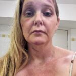 Imagens frescas apareceram pelas vítimas de tráfico sexual de Virginia Giuffre em hospitais com ferimentos faciais graves meses antes de tirar sua própria vida na Austrália Ocidental