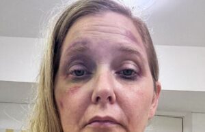 Dentro do mistério de novas fotos chocantes da vítima de Jeffrey Epstein, Virginia Giuffre, abusada e hematomas apenas algumas semanas antes de alegá -la ter quatro dias para morar – porque suas últimas palavras para seus filhos em uma listagem de suicídio são reveladas Imagens frescas apareceram pelas vítimas de tráfico sexual de Virginia Giuffre em hospitais com ferimentos faciais graves meses antes de tirar sua própria vida na Austrália Ocidental