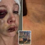 Fotos macabras mostram o rosto de uma mulher seriamente danificada durante a terrível luta de Cincinnati