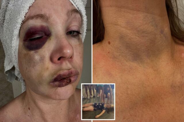Fotos macabras mostram o rosto de uma mulher seriamente danificada durante a terrível luta de Cincinnati

