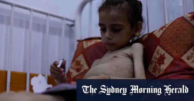 Imagens da UNICEF mostram os bebês pacientes por uma desnutrição acentuada em Gaza

