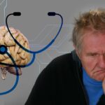 Doença de Alzheimer