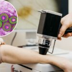 Os médicos criaram uma maneira de usar o herpes para combater o câncer avançado de curta duração