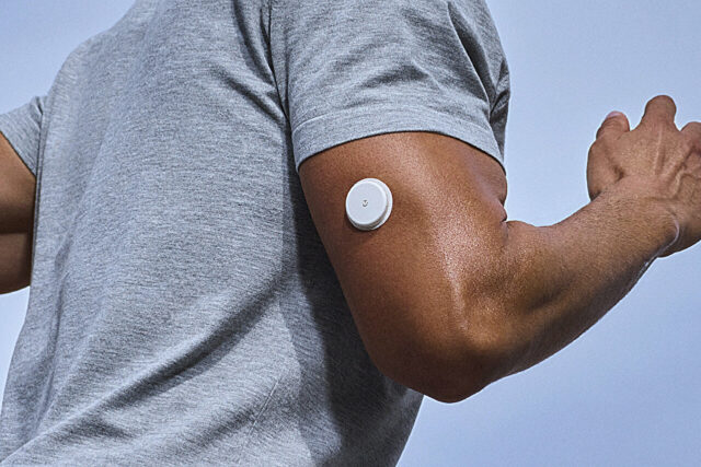 Os monitores contínuos de glicose estão na moda. Mas você realmente precisa rastrear seu açúcar no sangue?