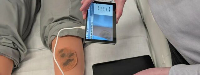 Os pesquisadores utilizam a IA para converter o diagnóstico de câncer de pele em áreas remotas